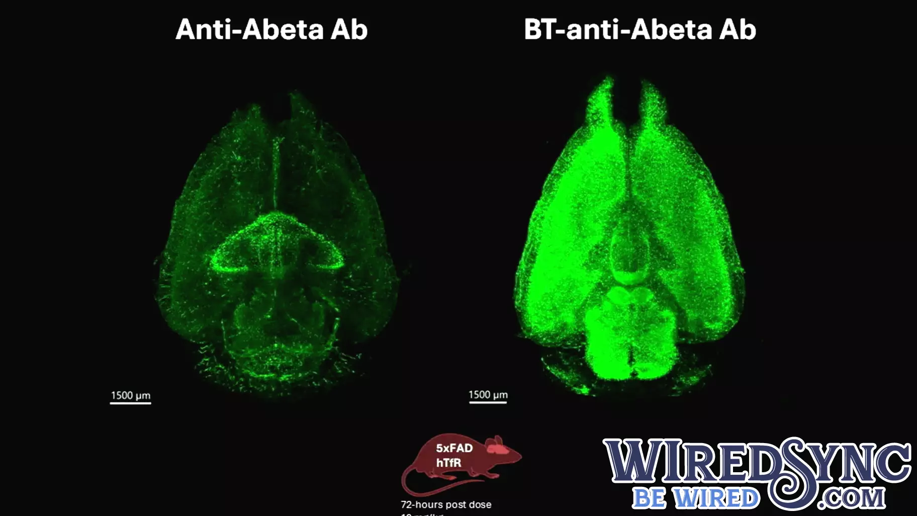 Innovative Technology Aims to Enhance Drug Delivery to the Brain